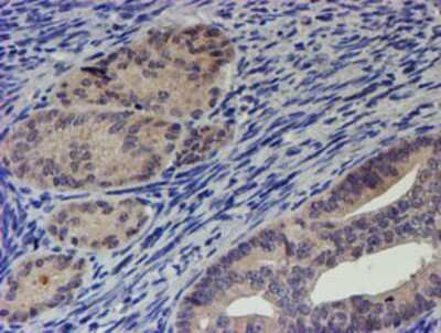 Immunohistochemistry-Paraffin: p70 S6 Kinase/S6K Antibody (OTI1G4) [NBP2-00754]