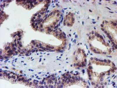 Immunohistochemistry-Paraffin: p70 S6 Kinase/S6K Antibody (OTI1G4) [NBP2-00754]