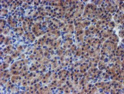 Immunohistochemistry-Paraffin: p70 S6 Kinase/S6K Antibody (OTI1G4) [NBP2-00754]
