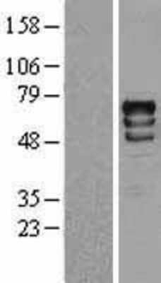 Western Blot: p70 S6 Kinase/S6K Overexpression Lysate [NBL1-15574]