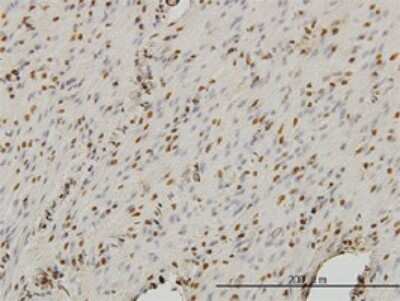 Immunohistochemistry-Paraffin: SA1 Antibody (2E9) [H00010274-M01]