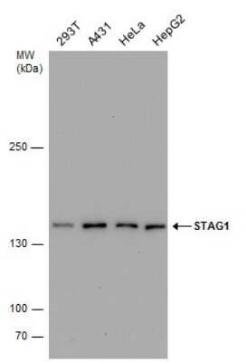 Western Blot: SA1 Antibody (8810) [NBP2-43750]
