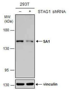 Western Blot: SA1 Antibody (8810) [NBP2-43750]