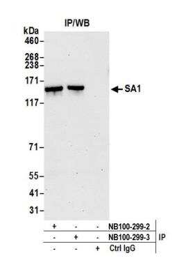 Immunoprecipitation: SA1 Antibody [NB100-299]