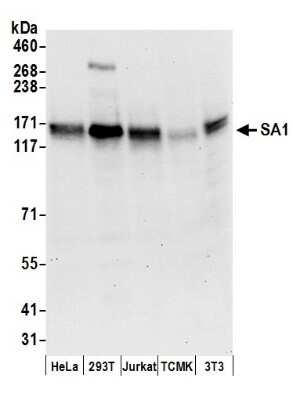 Western Blot: SA1 Antibody [NB100-299]