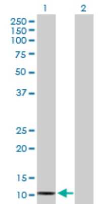 Western Blot: SAA2 Antibody [H00006289-D01P]