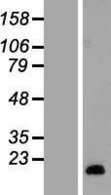 Western Blot: SAA2 Overexpression Lysate [NBL1-15672]