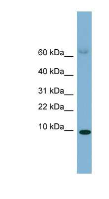 Western Blot: Serum Amyloid A4 Antibody [NBP1-58989]