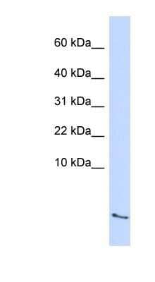 Western Blot: Serum Amyloid A4 Antibody [NBP1-58991]