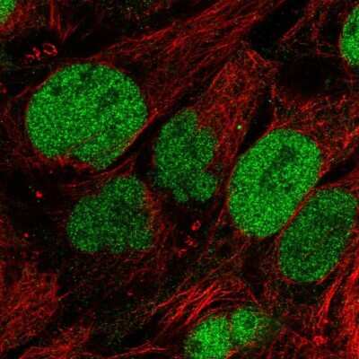 Immunocytochemistry/ Immunofluorescence: SAAL1 Antibody [NBP2-58797]