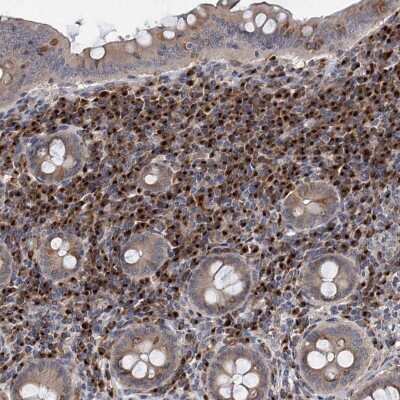Immunohistochemistry-Paraffin: SAAL1 Antibody [NBP1-83447]