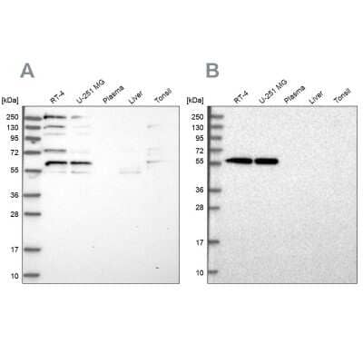 Western Blot: SAAL1 Antibody [NBP1-83447]