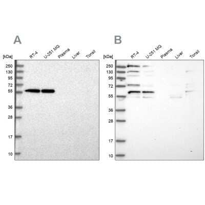 Western Blot: SAAL1 Antibody [NBP2-58797]