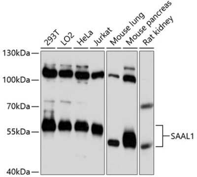 Western Blot: SAAL1 AntibodyAzide and BSA Free [NBP2-93623]