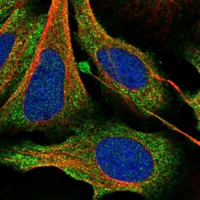 Immunocytochemistry/ Immunofluorescence: SAC3D1 Antibody [NBP1-81664]