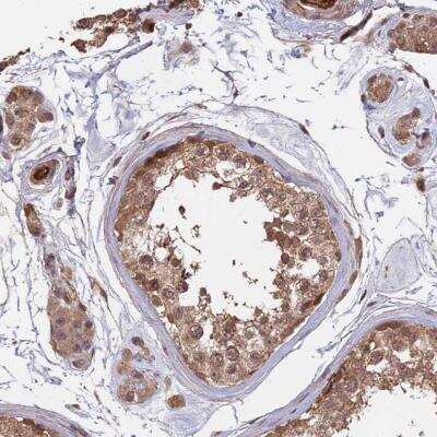 Immunohistochemistry: SAC3D1 Antibody [NBP1-81664]