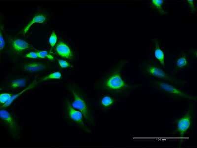 Immunocytochemistry/ Immunofluorescence: SACM1L Antibody [H00022908-D01P]