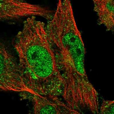 Immunocytochemistry/ Immunofluorescence: SACM1L Antibody [NBP2-55859]