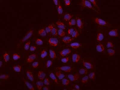 Immunocytochemistry/ Immunofluorescence: SACM1L Antibody [NBP2-97655]