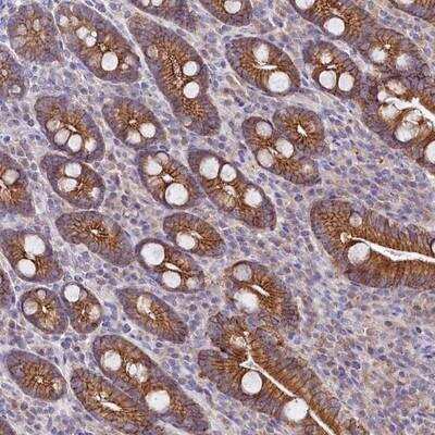 Immunohistochemistry-Paraffin: SACM1L Antibody [NBP1-81470]