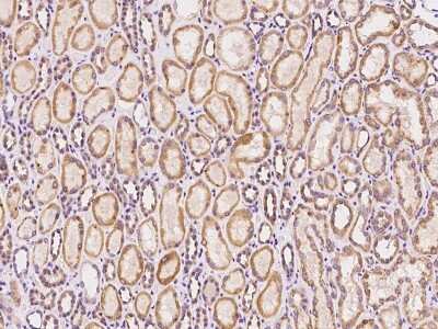Immunohistochemistry-Paraffin: SACM1L Antibody [NBP2-97655]