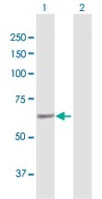 Western Blot: SACM1L Antibody [H00022908-D01P]