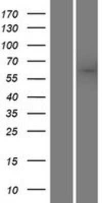 Western Blot: SACM1L Overexpression Lysate [NBP2-07389]