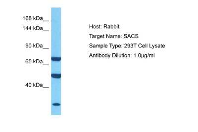 Western Blot: SACS Antibody [NBP2-86789]