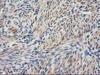 Immunohistochemistry-Paraffin: SAE2 Antibody (OTI4A3) [NBP2-03688]