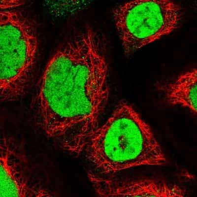 Immunocytochemistry/ Immunofluorescence: SAE2 Antibody [NBP2-34070]