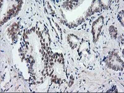Immunohistochemistry: SAE2 Antibody (OTI4A3) - Azide and BSA Free [NBP2-73973]