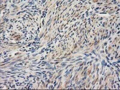 Immunohistochemistry: SAE2 Antibody (OTI4A3) - Azide and BSA Free [NBP2-73973]