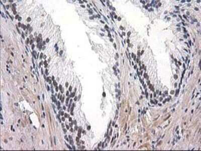 Immunohistochemistry: SAE2 Antibody (OTI4A3) - Azide and BSA Free [NBP2-73973]