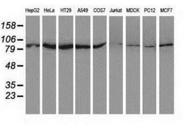 Western Blot: SAE2 Antibody (OTI4A3)Azide and BSA Free [NBP2-73973]