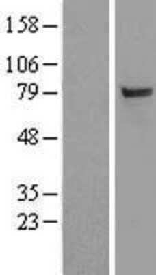 Western Blot: SAE2 Overexpression Lysate [NBL1-17496]