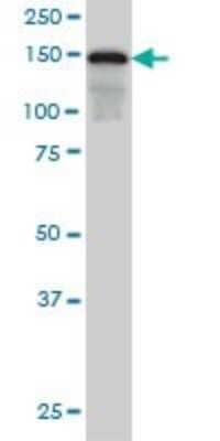 Western Blot: SAFB Antibody (5A11) [H00006294-M04]