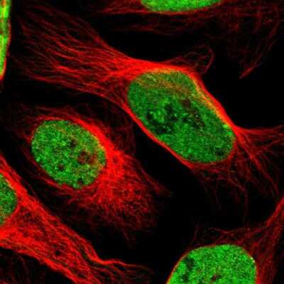 Immunocytochemistry/ Immunofluorescence: SAFB Antibody [NBP1-83266]