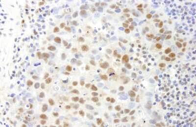 Immunohistochemistry: SAFB Antibody [NB100-2593]