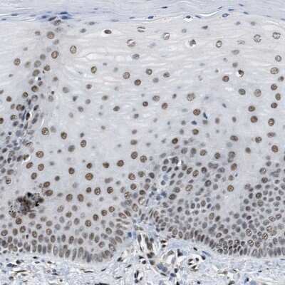 Immunohistochemistry-Paraffin: SAFB Antibody [NBP1-83266]