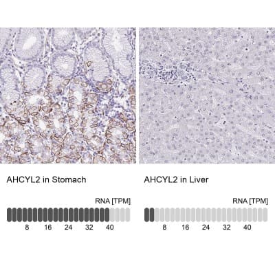 Immunohistochemistry-Paraffin: SAH3 Antibody [NBP2-47293]