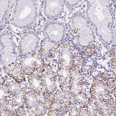 Immunohistochemistry-Paraffin: SAH3 Antibody [NBP2-47293]