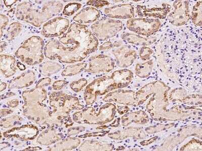 Immunohistochemistry-Paraffin: SAH3 Antibody [NBP2-98616]