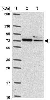 Western Blot: SAH3 Antibody [NBP2-47293]