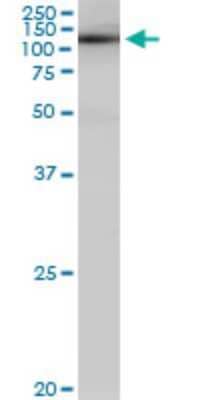 Western Blot: SALF Antibody (5F12) [H00286749-M01]