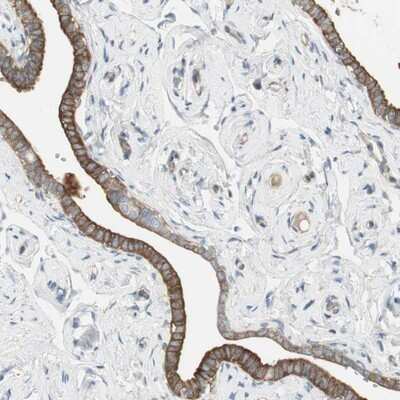 Immunohistochemistry-Paraffin: Stonin-1 Antibody [NBP1-80795]