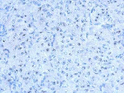 Immunohistochemistry-Paraffin: SALF Antibody [NBP2-20253]