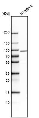 Western Blot: Stonin-1 Antibody [NBP1-80795]