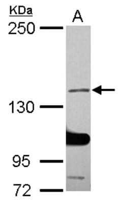 Western Blot: SALF Antibody [NBP2-20253]