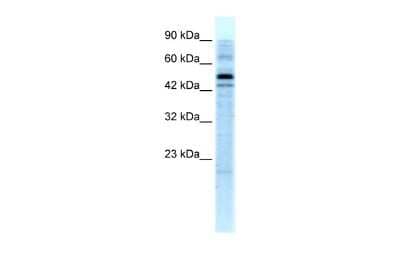 Western Blot: SALF Antibody [NBP2-86790]