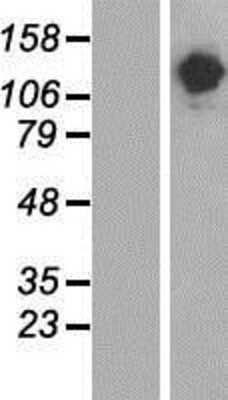 Western Blot: SALF Overexpression Lysate [NBP2-05159]